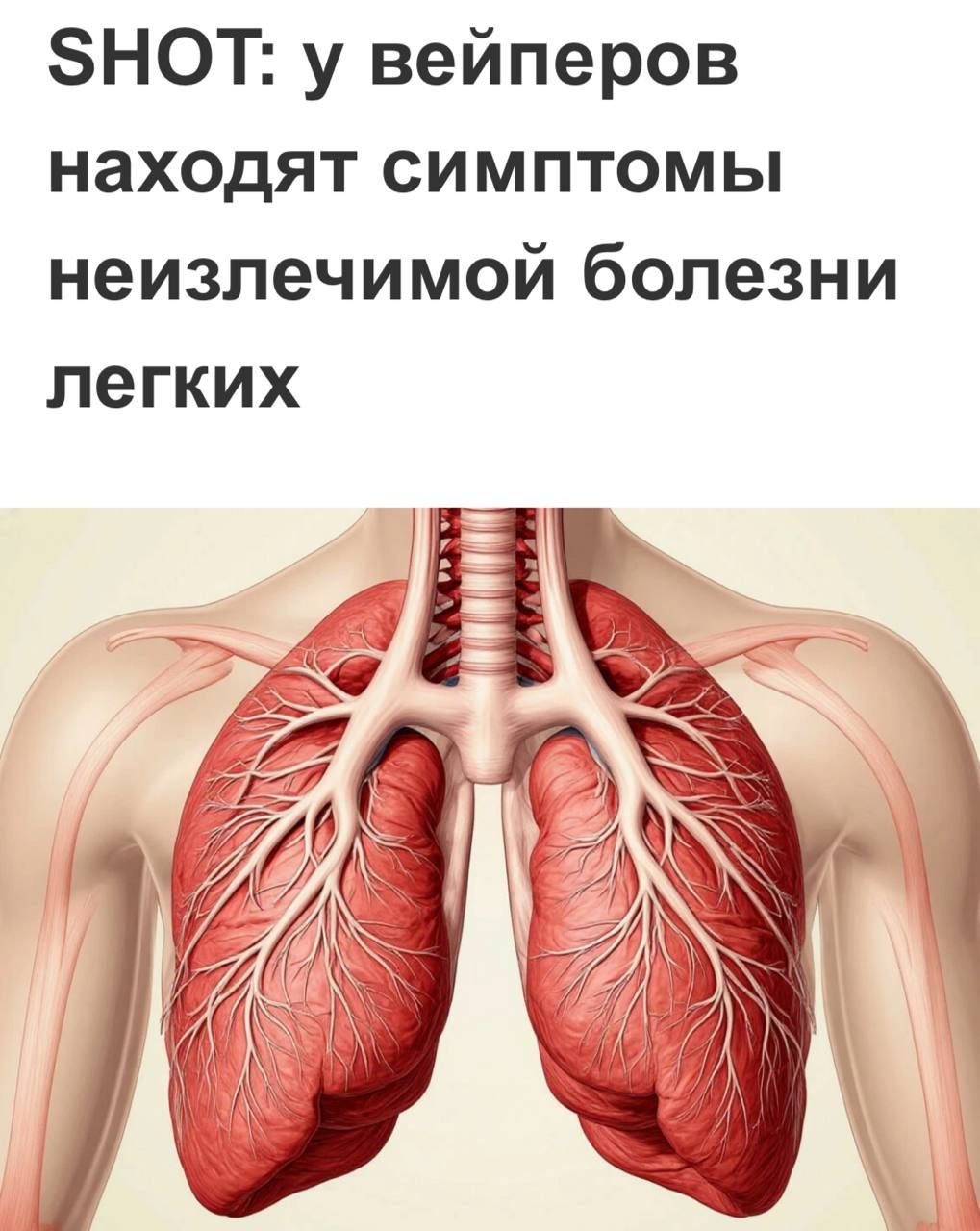 Вейперы в России массово заболевают неизлечимой болезнью лёгких